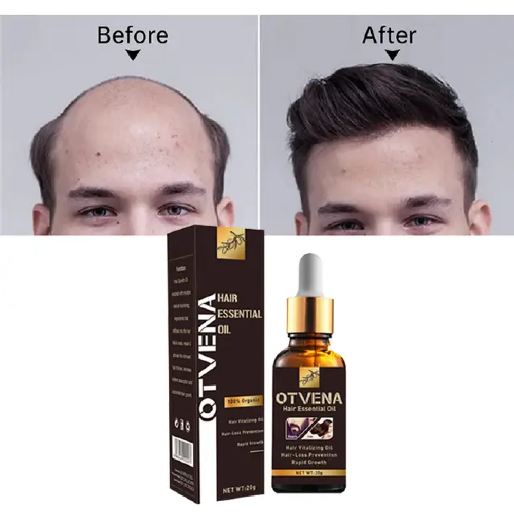 otvena hair growth