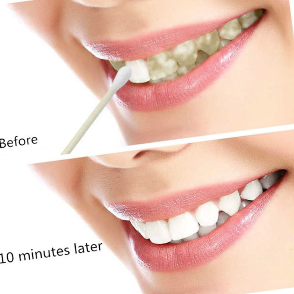 EFERO Teeth Whitening Essence Powder Oral Clean Serum Removes Plaque Stains Brightify Tooth Freshen Breath Bleaching Toothpaste