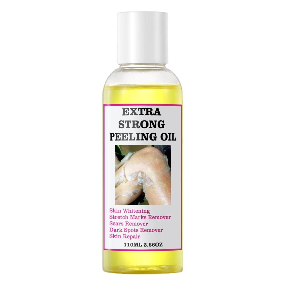 Extra Strong Peeling Oil, Stretch Mark Exfoliating Solution Whitening Oil, Skin Whitening, Stretch Marks Remover, Scar Remover