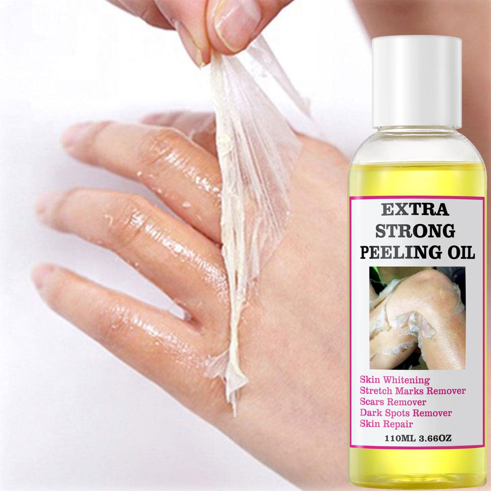 Extra Strong Peeling Oil, Stretch Mark Exfoliating Solution Whitening Oil, Skin Whitening, Stretch Marks Remover, Scar Remover