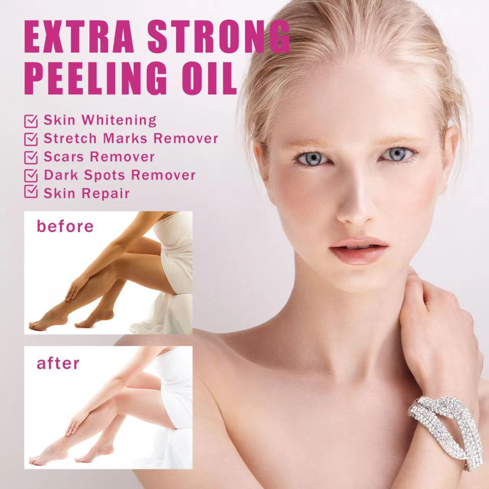 Extra Strong Peeling Oil, Stretch Mark Exfoliating Solution Whitening Oil, Skin Whitening, Stretch Marks Remover, Scar Remover