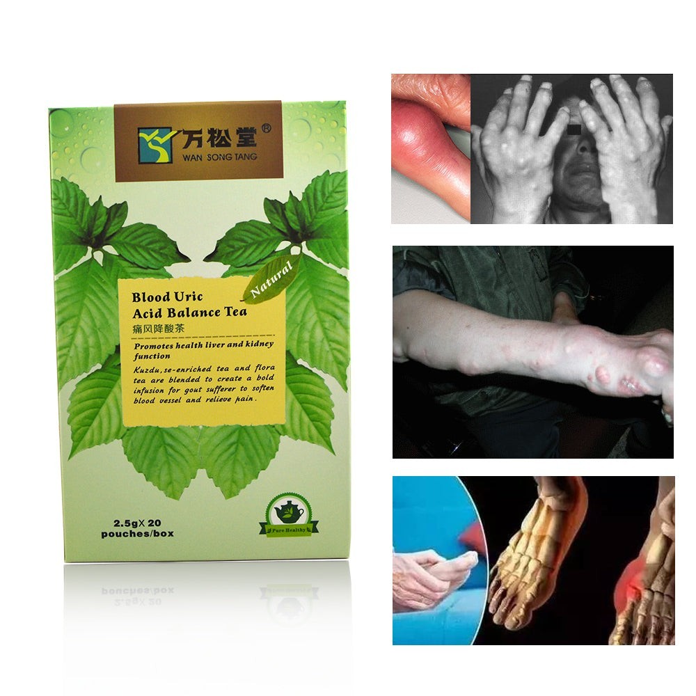 Blood Uric Acid Balance Tea | Herbal Tea for Blood Uric, Arthritis and Gout Treatment