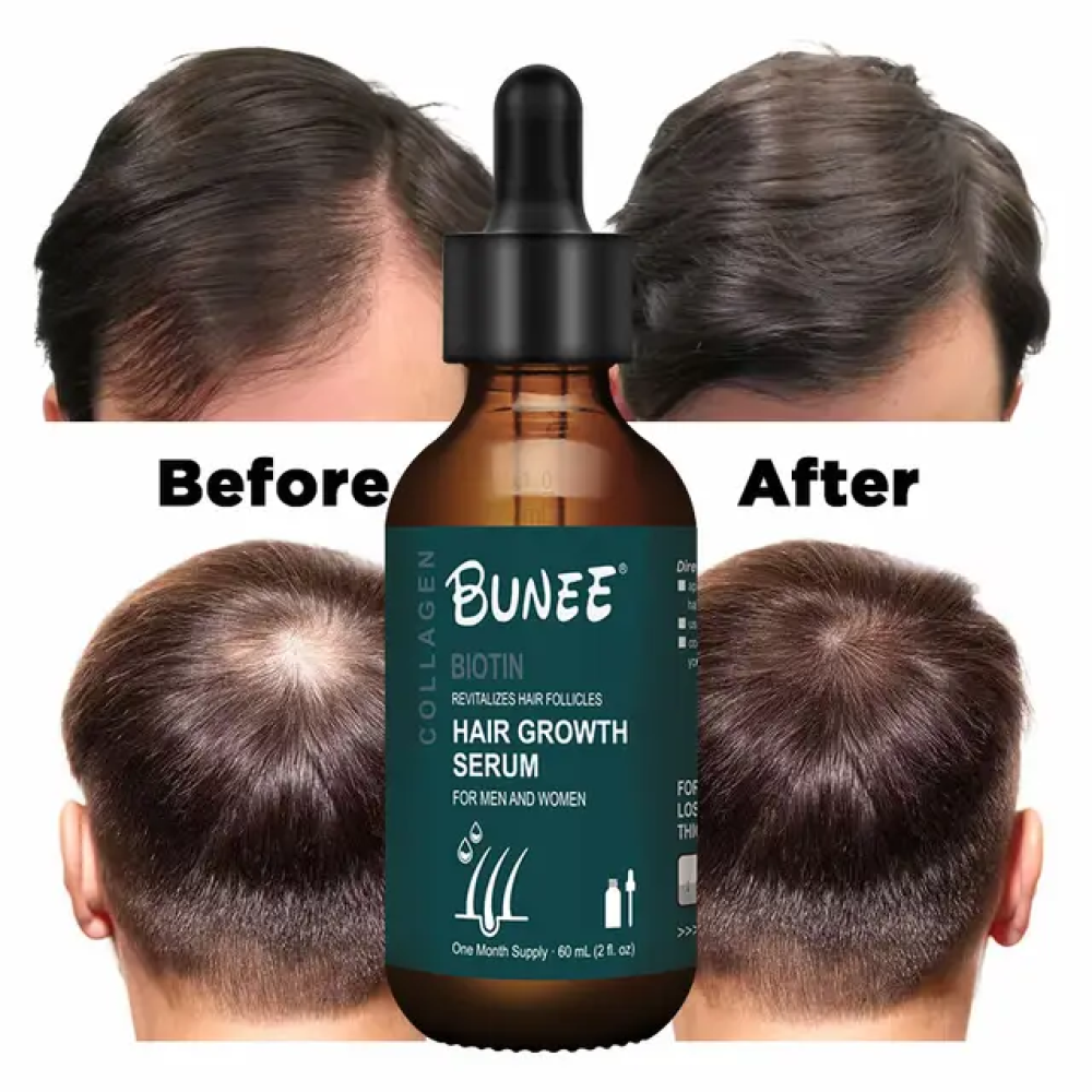 Hair Serum