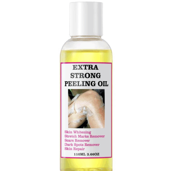 Extra Strong Peeling Oil, Stretch Mark Exfoliating Solution Whitening Oil, Skin Whitening, Stretch Marks Remover, Scar Remover