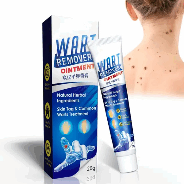 Wart Removal Body Wratten Treatment Cream Foot care Cream Skin Tag Remover Foot Corn Remove Wratten ointment